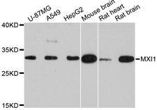 MXI1 / MAD2 Antibody - Western blot analysis of extracts of various cell lines, using MXI1 antibody at 1:3000 dilution. The secondary antibody used was an HRP Goat Anti-Rabbit IgG (H+L) at 1:10000 dilution. Lysates were loaded 25ug per lane and 3% nonfat dry milk in TBST was used for blocking. An ECL Kit was used for detection and the exposure time was 30s.