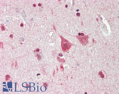 MXI1 / MAD2 Antibody - Human Brain, Cortex: Formalin-Fixed, Paraffin-Embedded (FFPE).  This image was taken for the unconjugated form of this product. Other forms have not been tested.