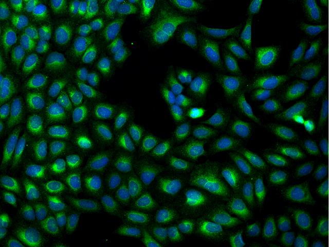 MXRA7 Antibody - Immunofluorescence staining of MXRA7 in U2OS cells. Cells were fixed with 4% PFA, permeabilzed with 0.1% Triton X-100 in PBS, blocked with 10% serum, and incubated with rabbit anti-Human MXRA7 polyclonal antibody (dilution ratio 1:200) at 4°C overnight. Then cells were stained with the Alexa Fluor 488-conjugated Goat Anti-rabbit IgG secondary antibody (green) and counterstained with DAPI (blue). Positive staining was localized to Cytoplasm.