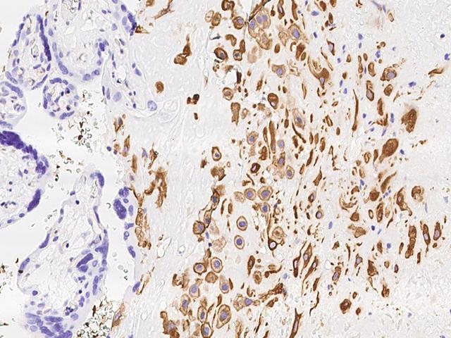 MXRA7 Antibody - Immunochemical staining of human MXRA7 in human placenta with rabbit polyclonal antibody at 1:2000 dilution, formalin-fixed paraffin embedded sections.