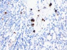 MYADM / Myeloid Marker BM-1 Antibody - IHC testing of FFPE human tonsil with MYDAM antibody (clone MYUP1).  This image was taken for the unmodified form of this product. Other forms have not been tested.