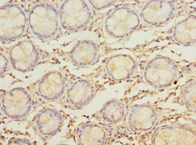MYADM / Myeloid Marker BM-1 Antibody - Immunohistochemistry of paraffin-embedded human rectum tissue using antibody at dilution of 1:100.