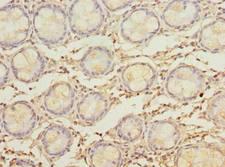 MYADM / Myeloid Marker BM-1 Antibody - Immunohistochemistry of paraffin-embedded human rectum tissue using antibody at dilution of 1:100.