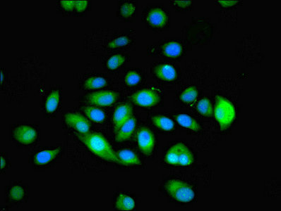 MYADM / Myeloid Marker BM-1 Antibody - Immunofluorescent analysis of A549 cells using MYADM Antibody at dilution of 1:100 and Alexa Fluor 488-congugated AffiniPure Goat Anti-Rabbit IgG(H+L)