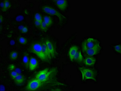 MYADM / Myeloid Marker BM-1 Antibody - Immunofluorescent analysis of MCF-7 cells using MYADM Antibody at dilution of 1:100 and Alexa Fluor 488-congugated AffiniPure Goat Anti-Rabbit IgG(H+L)