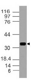 MYADM / Myeloid Marker BM-1 Antibody - Fig-1: Western blot analysis of MYADM. Anti-MYADM antibody was used at 1 µg/ml on h Lung lysate.