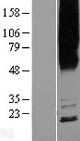 MYADM / Myeloid Marker BM-1 Protein - Western validation with an anti-DDK antibody * L: Control HEK293 lysate R: Over-expression lysate