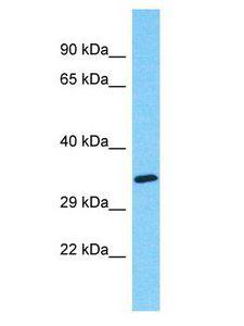 MYADML2 Antibody - MYADML2 antibody Western Blot of HeLa. Antibody dilution: 1 ug/ml.  This image was taken for the unconjugated form of this product. Other forms have not been tested.