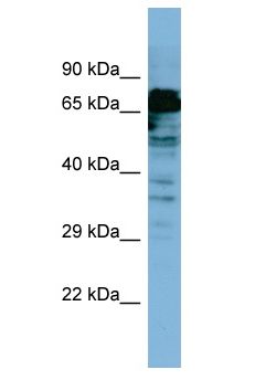 MYB / c-Myb Antibody - MYB / c-Myb antibody Western Blot of OVCAR-3. Antibody dilution: 1 ug/ml.  This image was taken for the unconjugated form of this product. Other forms have not been tested.