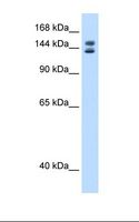 MYBBP1A Antibody - SP2/0 cell lysate. Antibody concentration: 0.25 ug/ml. Gel concentration: 8%.  This image was taken for the unconjugated form of this product. Other forms have not been tested.