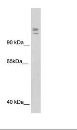 MYBBP1A Antibody - SP2/0 Cell Lysate.  This image was taken for the unconjugated form of this product. Other forms have not been tested.