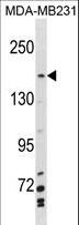 MYBBP1A Antibody - MYBBP1A Antibody western blot of MDA-MB231 cell line lysates (35 ug/lane). The MYBBP1A antibody detected the MYBBP1A protein (arrow).