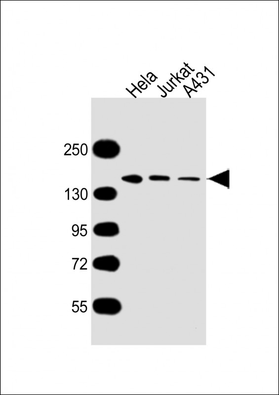 MYBBP1A Antibody - All lanes: Anti-MYBBP1A Antibody at 1:5000 dilution Lane 1: Hela whole cell lysate Lane 2: Jurkat whole cell lysate Lane 3: A431 whole cell lysate Lysates/proteins at 20 µg per lane. Secondary Goat Anti-mouse IgG, (H+L), Peroxidase conjugated at 1/10000 dilution. Predicted band size: 149 kDa Blocking/Dilution buffer: 5% NFDM/TBST.