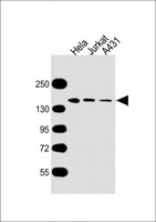 MYBBP1A Antibody - All lanes: Anti-MYBBP1A Antibody at 1:5000 dilution Lane 1: Hela whole cell lysate Lane 2: Jurkat whole cell lysate Lane 3: A431 whole cell lysate Lysates/proteins at 20 µg per lane. Secondary Goat Anti-mouse IgG, (H+L), Peroxidase conjugated at 1/10000 dilution. Predicted band size: 149 kDa Blocking/Dilution buffer: 5% NFDM/TBST.