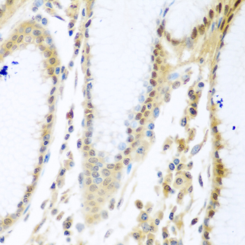 MYBBP1A Antibody - Immunohistochemistry of paraffin-embedded human stomach tissue.