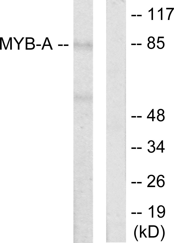MYBL1 / A-MYB Antibody - Western blot analysis of lysates from LOVO cells, using MYB-A Antibody. The lane on the right is blocked with the synthesized peptide.