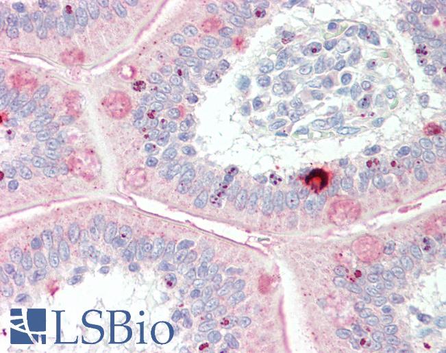 MYBL1 / A-MYB Antibody - Anti-MYBL1 / A-MYB antibody IHC staining of human small intestine. Immunohistochemistry of formalin-fixed, paraffin-embedded tissue after heat-induced antigen retrieval. Antibody concentration 10 ug/ml.  This image was taken for the unconjugated form of this product. Other forms have not been tested.