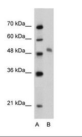 MYBL1 / A-MYB Antibody - Jurkat Cell Lysate.  This image was taken for the unconjugated form of this product. Other forms have not been tested.