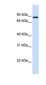 MYBL1 / A-MYB Antibody - MYBL1 antibody Western blot of Fetal Muscle lysate. This image was taken for the unconjugated form of this product. Other forms have not been tested.