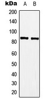 MYBL1 / A-MYB Antibody - Western blot analysis of A-MYB expression in Jurkat (A); Raw264.7 (B) whole cell lysates.