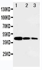 MYBL2 Antibody - WB of MYBL2 antibody. Recombinant Protein Detection Source:. E.coli derived -recombinant Human MYBL2, 46.8KD. (162aa tag+ M1-L245). Lane 1: Recombinant Human MYBL2 Protein 10ng. Lane 2: Recombinant Human MYBL2 Protein 5ng. Lane 3: Recombinant Human MYBL2 Protein 2.5ng.