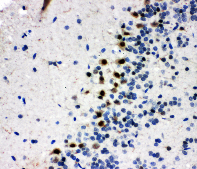 MYBL2 Antibody - MYBL2 antibody. IHC(P): Rat Brain Tissue.