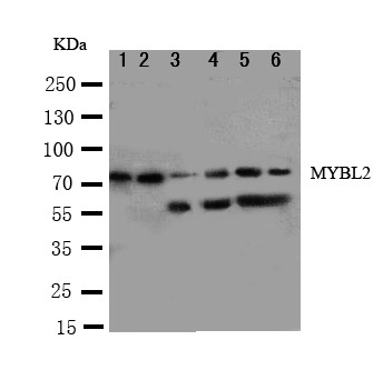 MYBL2 Antibody - WB of MYBL2 antibody. Lane 1: Rat Spleen Tissue Lysate. Lane 2: Rat Thymus Tissue Lysate. Lane 3: Rat Brain Tissue Lysate. Lane 4: HELA Cell Lysate. Lane 5: COLO320 Cell Lysate. Lane 6: MCF-7 Cell Lysate.