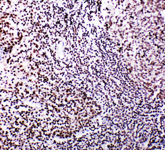 MYBL2 Antibody - MYBL2 antibody. IHC(P): Human Tonsil Tissue.