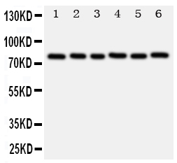MYBL2 Antibody - Anti-B MyB antibody, Western blotting Lane 1: Rat Spleen Tissue LysateLane 2: Rat Thymus Tissue LysateLane 3: Rat Brain Tissue LysateLane 4: HELA Cell LysateLane 5: COLO320 Cell LysateLane 6: MCF-7 Cell Lysate