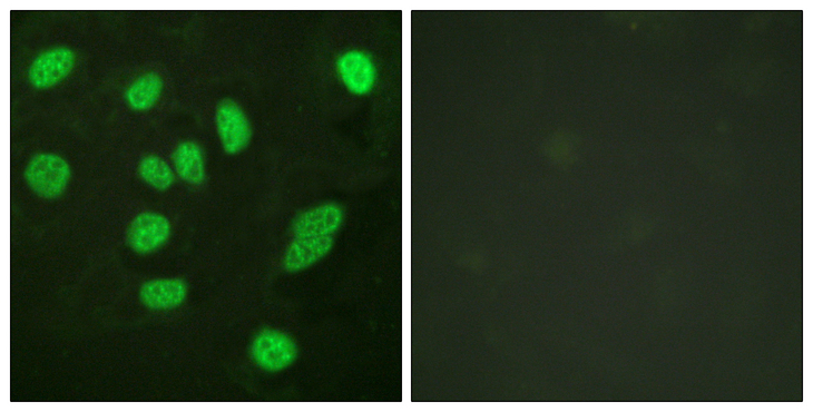 MYBL2 Antibody - Immunofluorescence analysis of HeLa cells, using B-Myb Antibody. The picture on the right is blocked with the synthesized peptide.