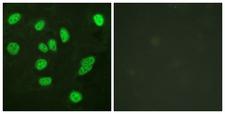 MYBL2 Antibody - Immunofluorescence analysis of HeLa cells, using B-Myb Antibody. The picture on the right is blocked with the synthesized peptide.