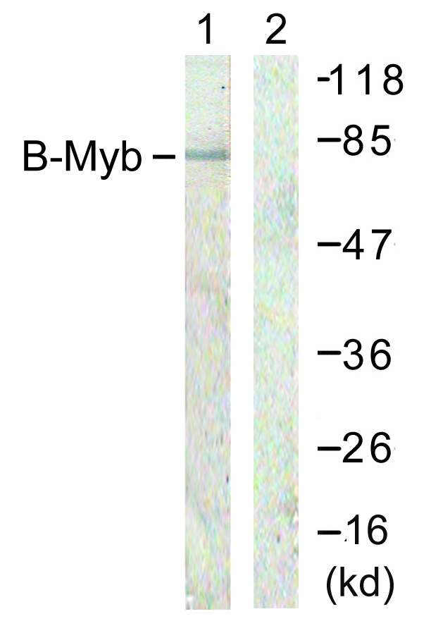 MYBL2 Antibody - Western blot analysis of lysates from A549 cells, using B-Myb Antibody. The lane on the right is blocked with the synthesized peptide.