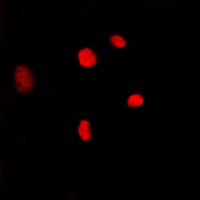 MYBL2 Antibody - Immunofluorescent analysis of MYBL2 staining in K562 cells. Formalin-fixed cells were permeabilized with 0.1% Triton X-100 in TBS for 5-10 minutes and blocked with 3% BSA-PBS for 30 minutes at room temperature. Cells were probed with the primary antibody in 3% BSA-PBS and incubated overnight at 4 deg C in a humidified chamber. Cells were washed with PBST and incubated with a DyLight 594-conjugated secondary antibody (red) in PBS at room temperature in the dark. DAPI was used to stain the cell nuclei (blue).