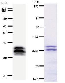 MYBL2 Antibody - Western blot of immunized recombinant protein using MYBL2 antibody. Left: MYBL2 staining. Right: Coomassie Blue staining of immunized recombinant protein.