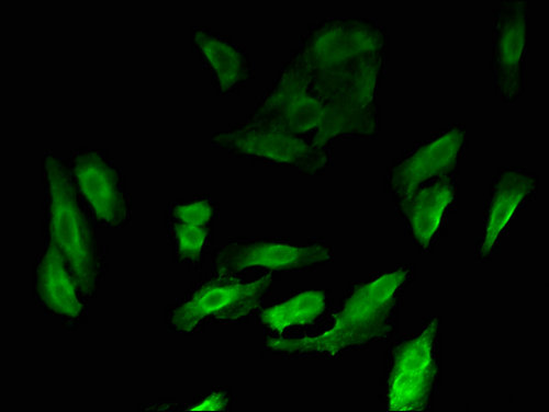 MYBL2 Antibody - Immunofluorescent analysis of Hela cells using MYBL2 Antibody at a dilution of 1:100 and Alexa Fluor 488-congugated AffiniPure Goat Anti-Rabbit IgG(H+L)