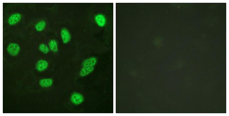 MYBL2 Antibody - Peptide - + Immunofluorescence analysis of HeLa cells, using B-Myb (Ab-577/581) antibody.