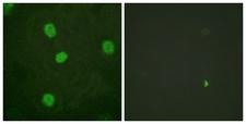 MYBL2 Antibody - P-peptide - + Immunofluorescence analysis of HeLa cells, t using B-Myb (Phospho-Ser577/581) antibody.