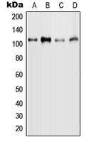MYBL2 Antibody - Western blot analysis of MYBL2 (pS577) expression in MCF7 (A); HeLa (B); mouse liver (C); rat liver (D) whole cell lysates.