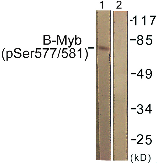 MYBL2 Antibody - Western blot analysis of lysates from K562 cells, using B-Myb (Phospho-Ser577/581) Antibody. The lane on the right is blocked with the phospho peptide.