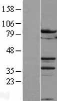 MYBL2 Protein - Western validation with an anti-DDK antibody * L: Control HEK293 lysate R: Over-expression lysate