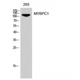 MYBPC1 Antibody - Western blot of MYBPC1 antibody
