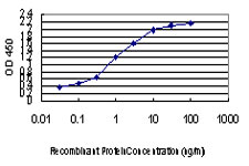 MYBPC1 Antibody - Detection limit for recombinant GST tagged MYBPC1 is approximately 0.03 ng/ml as a capture antibody.
