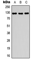 MYBPC1 Antibody - Western blot analysis of MYBPC1 expression in U2OS (A); mouse skeletal muscle (B); rat skeletal muscle (C) whole cell lysates.