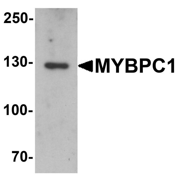 MYBPC1 Antibody - Western blot analysis of MYBPC1 in rat skeletal muscle tissue lysate with MYBPC1 antibody at 1 ug/ml.
