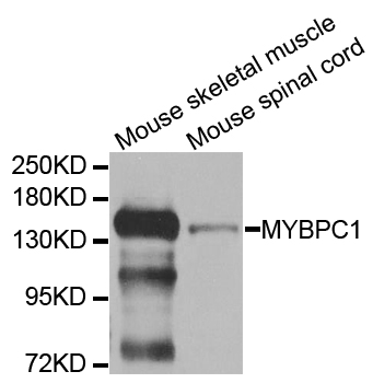 MYBPC1 Antibody - Western blot analysis of extracts of various cell lines.