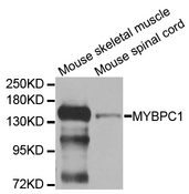 MYBPC1 Antibody - Western blot analysis of extracts of various cell lines.