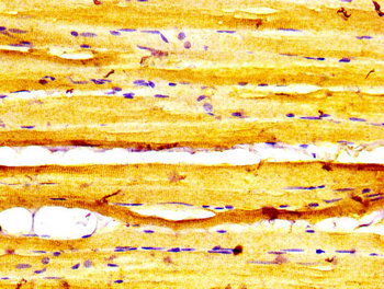 MYBPC1 Antibody - Immunohistochemistry image at a dilution of 1:600 and staining in paraffin-embedded human skeletal muscle tissue performed on a Leica BondTM system. After dewaxing and hydration, antigen retrieval was mediated by high pressure in a citrate buffer (pH 6.0) . Section was blocked with 10% normal goat serum 30min at RT. Then primary antibody (1% BSA) was incubated at 4 °C overnight. The primary is detected by a biotinylated secondary antibody and visualized using an HRP conjugated SP system.