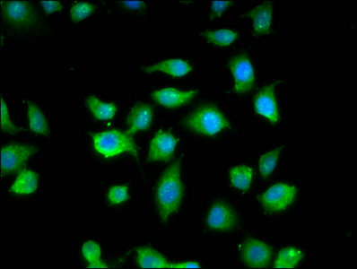 MYBPC1 Antibody - Immunofluorescence staining of A549 cells with MYBPC1 Antibody at 1:200, counter-stained with DAPI. The cells were fixed in 4% formaldehyde, permeabilized using 0.2% Triton X-100 and blocked in 10% normal Goat Serum. The cells were then incubated with the antibody overnight at 4°C. The secondary antibody was Alexa Fluor 488-congugated AffiniPure Goat Anti-Rabbit IgG(H+L).