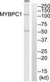 MYBPC1 Antibody - Western blot analysis of extracts from 293 cells, using MYBPC1 antibody.