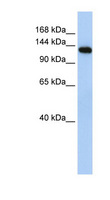 MYBPC2 Antibody - MYBPC2 antibody Western blot of Fetal Muscle lysate. This image was taken for the unconjugated form of this product. Other forms have not been tested.